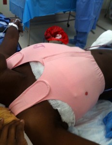 Medebra being used after surgery