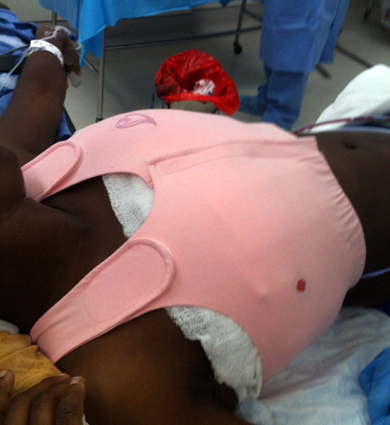 Medebra being used after surgery